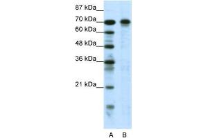 Human Jurkat; WB Suggested Anti-HIC1 Antibody Titration: 0. (HIC1 anticorps  (N-Term))