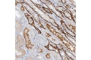 Immunohistochemical staining of human kidney with ATP11A polyclonal antibody  shows strong cytoplasmic and membranous positivity in distal tubules. (ATP11A anticorps)