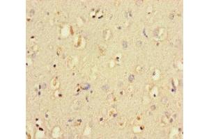 Immunohistochemistry of paraffin-embedded human brain tissue using ABIN7150193 at dilution of 1:100