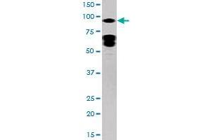 Western blot analysis of STAT5A (phospho Y694) polyclonal antibody  in HepG2 cell lysate (35 ug/lane). (STAT5A anticorps  (pTyr694))