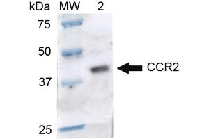 Western blot analysis of Rat Brain cell lysates showing detection of ~41. (CCR2 anticorps  (HRP))