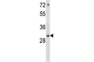 ATF5 antibody western blot analysis in MCF-7 lysate