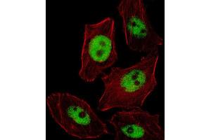 Immunofluorescence (IF) image for anti-Paired-Like Homeobox 2b (PHOX2B) antibody (ABIN2996148) (PHOX2B anticorps)