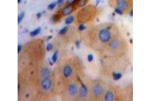 anti-Chromosome 19 Open Reading Frame 80 (C19ORF80) (AA 24-196) antibody