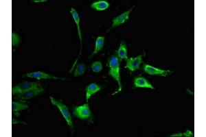 Immunofluorescent analysis of Hela cells using ABIN7160009 at dilution of 1:100 and Alexa Fluor 488-congugated AffiniPure Goat Anti-Rabbit IgG(H+L)