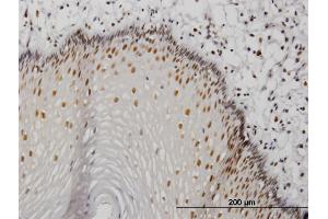 Immunoperoxidase of monoclonal antibody to MTA1 on formalin-fixed paraffin-embedded human esophagus.