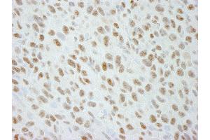 anti-DEAD (Asp-Glu-Ala-Asp) Box Polypeptide 21 (DDX21) (C-Term) antibody