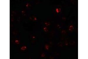 Immunofluorescence of ZBTB40 in Raji cells with ZBTB40 antibody at 20 µg/ml. (ZBTB40 anticorps  (N-Term))