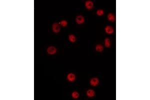 ABIN6266525 staining Hela by IF/ICC. (Cyclin G1 anticorps  (Internal Region))