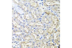 Immunohistochemistry of paraffin-embedded rat kidney using LRP2 antibody (ABIN1680712, ABIN3017881, ABIN3017882 and ABIN6220293) at dilution of 1:100 (40x lens). (LRP2 anticorps  (AA 4446-4655))