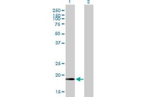 Western Blot analysis of CETN2 expression in transfected 293T cell line by CETN2 MaxPab polyclonal antibody. (CETN2 anticorps  (AA 1-172))