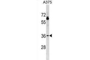Western Blotting (WB) image for anti-Olfactory Receptor, Family 51, Subfamily T, Member 1 (OR51T1) antibody (ABIN3000143) (OR51T1 anticorps)