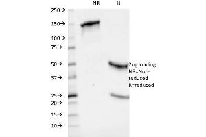 SDS-PAGE Analysis Purified HLA-ABC Mouse Monoclonal Antibody (246-B8. (HLA-ABC anticorps)