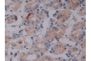 DAB staining on IHC-P; Samples: Human Stomach Tissue (LTBP2 anticorps  (AA 522-814))