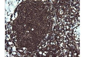 Image no. 2 for anti-V-Ets Erythroblastosis Virus E26 Oncogene Homolog 2 (ETS2) (AA 90-349) antibody (ABIN1491703) (ETS2 anticorps  (AA 90-349))