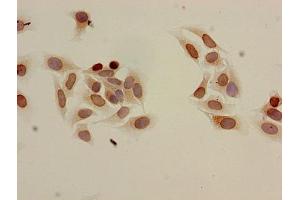 Immunocytochemistry analysis of Hela cells using ABIN7139204 at dilution of 1:100