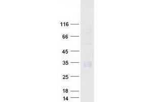Validation with Western Blot