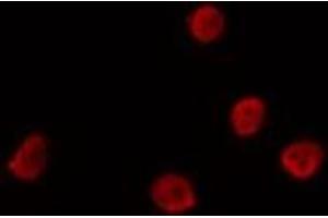 ABIN6275719 staining Hela by IF/ICC. (SMUG1 anticorps  (Internal Region))