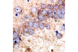 Immunohistochemistry (IHC) image for anti-TNF Receptor-Associated Protein 1 (TRAP1) antibody (ABIN7308438)