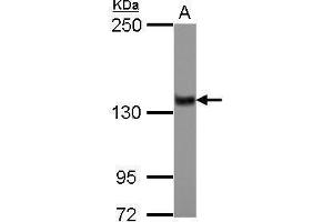 WB Image Sample (30 ug of whole cell lysate) A: IMR32 5% SDS PAGE antibody diluted at 1:1000 (ZNF217 anticorps)