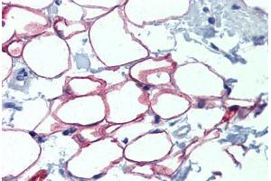 Adipocytes, Human: Formalin-Fixed, Paraffin-Embedded (FFPE) (NFIC anticorps  (AA 323-372))