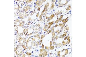Immunohistochemistry of paraffin-embedded human stomach using MAVS antibody (ABIN6132297, ABIN6143583, ABIN6143584 and ABIN6221441) at dilution of 1:100 (40x lens).