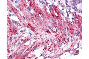Immunohistochemistry (IHC) image for anti-Sirtuin 5 (SIRT5) (Middle Region) antibody (ABIN405300) (SIRT5 anticorps  (Middle Region))