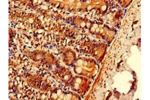 Immunohistochemistry of paraffin-embedded human small intestine tissue using ABIN7151962 at dilution of 1:100 (EPN3 anticorps  (AA 25-208))