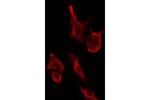 ABIN6275173 staining LOVO cells by IF/ICC. (SAR1B anticorps  (Internal Region))