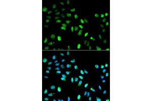 Immunofluorescence analysis of HeLa cell using MAD1L1 antibody. (MAD1L1 anticorps)