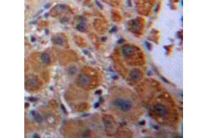 Used in DAB staining on fromalin fixed paraffin-embedded Liver tissue (KNG1 anticorps  (AA 22-379))