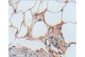 IHC-P analysis of Kidney tissue, with DAB staining. (TLR5 anticorps  (AA 325-644))