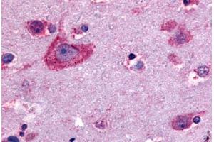 Anti-Delta Opioid Receptor antibody  ABIN1048497 IHC staining of human brain, neurons and glia.