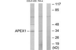 Western blot analysis of extracts from COLO205/HeLa cells, using APEX1 Antibody. (APEX1 anticorps  (AA 191-240))