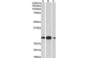 ABIN1590003 (1µg/ml) staining of Human (A), Mouse (B) and rat (C) Kidney lysates (35µg protein in RIPA buffer).