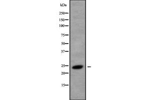 Western blot analysis of CREG1 using K562 whole cell lysates (CREG1 anticorps  (C-Term))