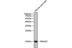 Western blot analysis of extracts of Mouse pancreas using RNASE1 Polyclonal Antibody at dilution of 1:1000. (RNASE1 anticorps)