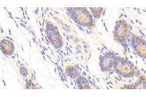 Detection of ADAM12 in Human Uterus Tissue using Polyclonal Antibody to A Disintegrin And Metalloprotease 12 (ADAM12)