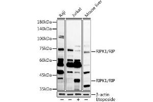 Western blot analysis of extracts of various cell lines, using RIPK1/RIP antibody (ABIN6132596, ABIN6146959, ABIN6146960 and ABIN6223282) at 1:1000 dilution. (RIPK1 anticorps  (AA 170-440))