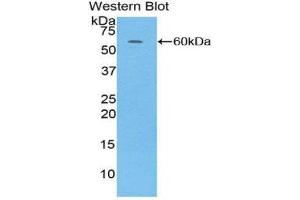 Western Blotting (WB) image for anti-Complement Factor D (CFD) (AA 1-253) antibody (ABIN1858379) (Adipsin anticorps  (AA 1-253))