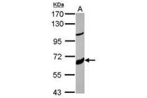 Image no. 1 for anti-Cytochrome P450, Family 17, Subfamily A, Polypeptide 1 (CYP17A1) (AA 13-366) antibody (ABIN1497707) (CYP17A1 anticorps  (AA 13-366))