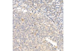 Immunohistochemistry of paraffin-embedded human tonsil using IL21 Rabbit pAb (ABIN6128086, ABIN6142359, ABIN6142360 and ABIN6223071) at dilution of 1:50 (40x lens). (IL-21 anticorps  (AA 25-162))