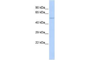 WB Suggested Anti-NFIC Antibody Titration:  1 ug/ml  Positive Control:  MCF-7 whole cell lysates (NFIC anticorps  (Middle Region))