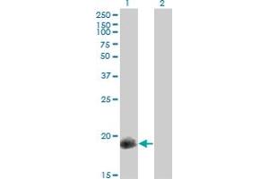 Western Blot analysis of PPP1R14A expression in transfected 293T cell line by PPP1R14A monoclonal antibody (M01), clone 3A7.