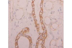 IHC-P analysis of Kidney tissue, with DAB staining. (NKp44/NCR2 anticorps  (AA 22-120))