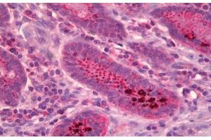 Anti-Protein Phosphatase 2 A/B Alpha antibody IHC staining of human small intestine.