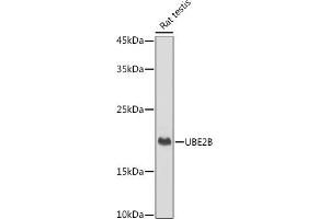 UBE2B anticorps
