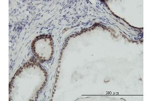 Immunoperoxidase of monoclonal antibody to RPA3 on formalin-fixed paraffin-embedded human prostate.