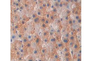 Used in DAB staining on fromalin fixed paraffin- embedded liver tissue