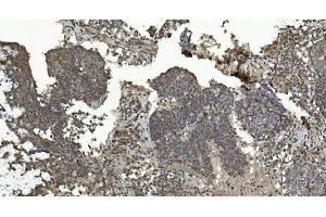 IHC analysis of ERK5/MAPK7 using anti-ERK5/MAPK7 antibody (ABIN7600701). (MAPK7 anticorps  (AA 22-816))